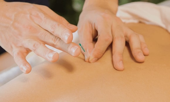 Massage Acupuncture